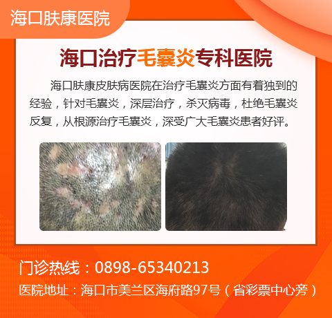 治疗毛囊炎需要什么方法?