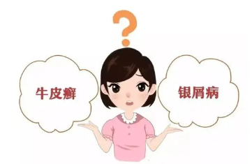 海口市好的银屑病医院是那家