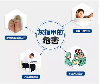 灰指甲海口哪家医院比较好