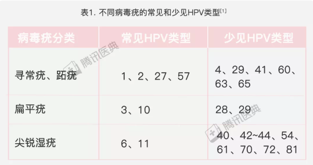 海口看扁平疣医院